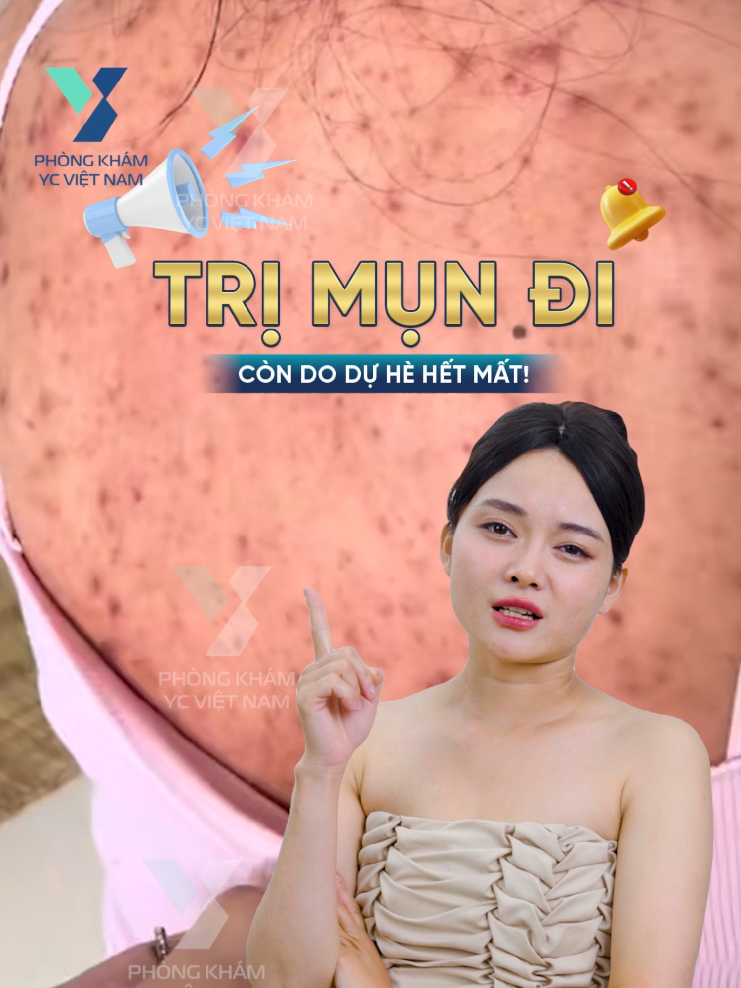 Điều trị mọi tình trạng viên nang lông, mụn thâm, mụn viêm mọi cấp độ. Cam kết hiệu quả bằng văn bản #mụn_viêm #mụnlưng #sẹo_thâm #thâm_mụn #mụn_thâm_lưng #viemnanglong #thâm #daysungnanglong #thammyvien #làmđẹp #xuhuong #thâmchân #viemda #viemdacodia #mẩnngứa