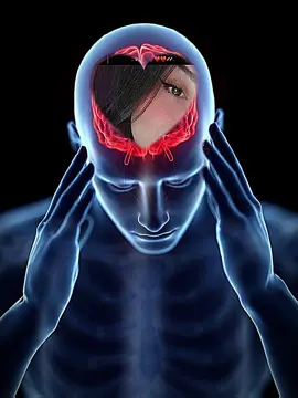 #CapCut 