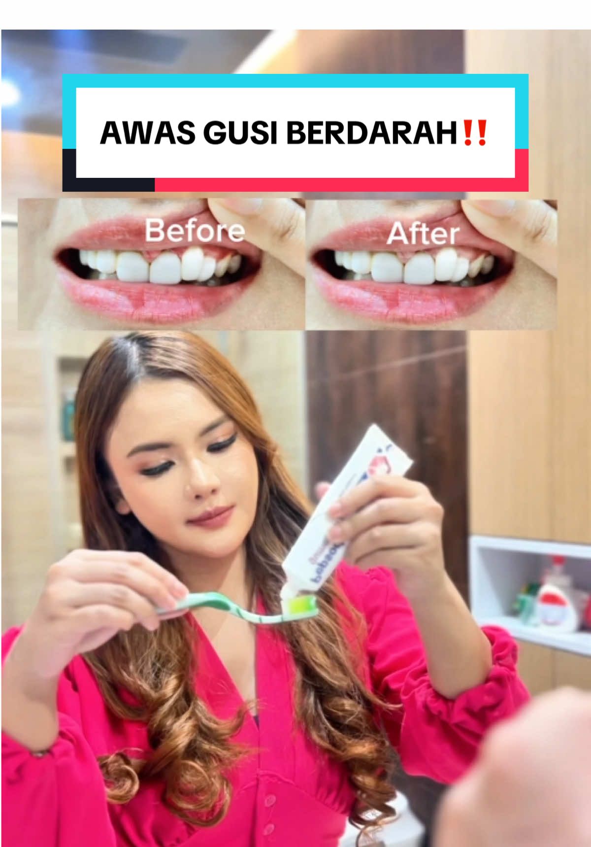 Semakin bertambah usia, harusnya sih makin aware sama yang namanya masalah gigi dan gusi. maka dari itu mulai sekarang stop ngegampangin isu gusi.  untuk mencegah hal tersebut, aku pilih Pepsodent Gum Expert yg memang 100% diformulasikan untuk merawat gusi dan memang sudah direkomendasikan juga oleh expert. Berita baiknya saat ini kita bisa konsultasi gratis loh dgn cara scan QR kode yg ada pada bagian belakang kemasan Pepsodent! Yuk #PilihyangExpert