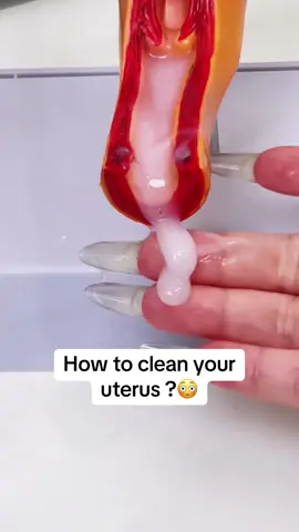 How to clean it