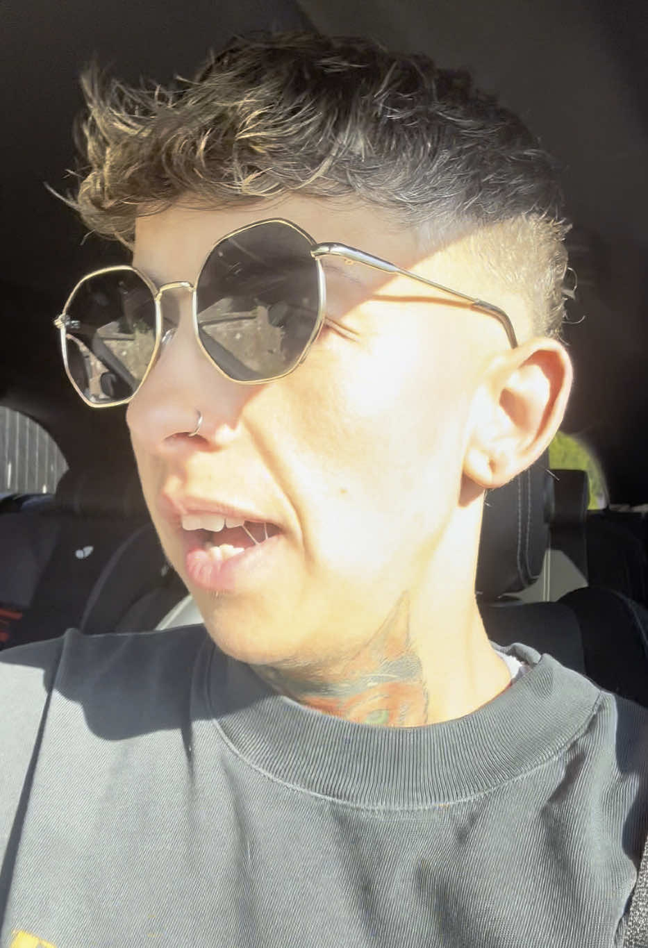 I’m getting my Braces on today 😭😂 #braces #mumsoftiktok 