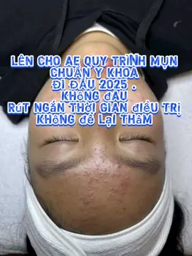 📛LÊN CHO AE QUY TRÌNH MỤN CHUẨN Y KHOA ĐI ĐẦU 2025 . Không đau ,rút ngắn thời gian điều trị , không để lại thâm ...#TrịMụnHiệuQuả #SerumChoDaMụn #SkincareChuẩnXịn #chamsocda #spa #DaotaoSpachuyennghiep #thoanovirlab 