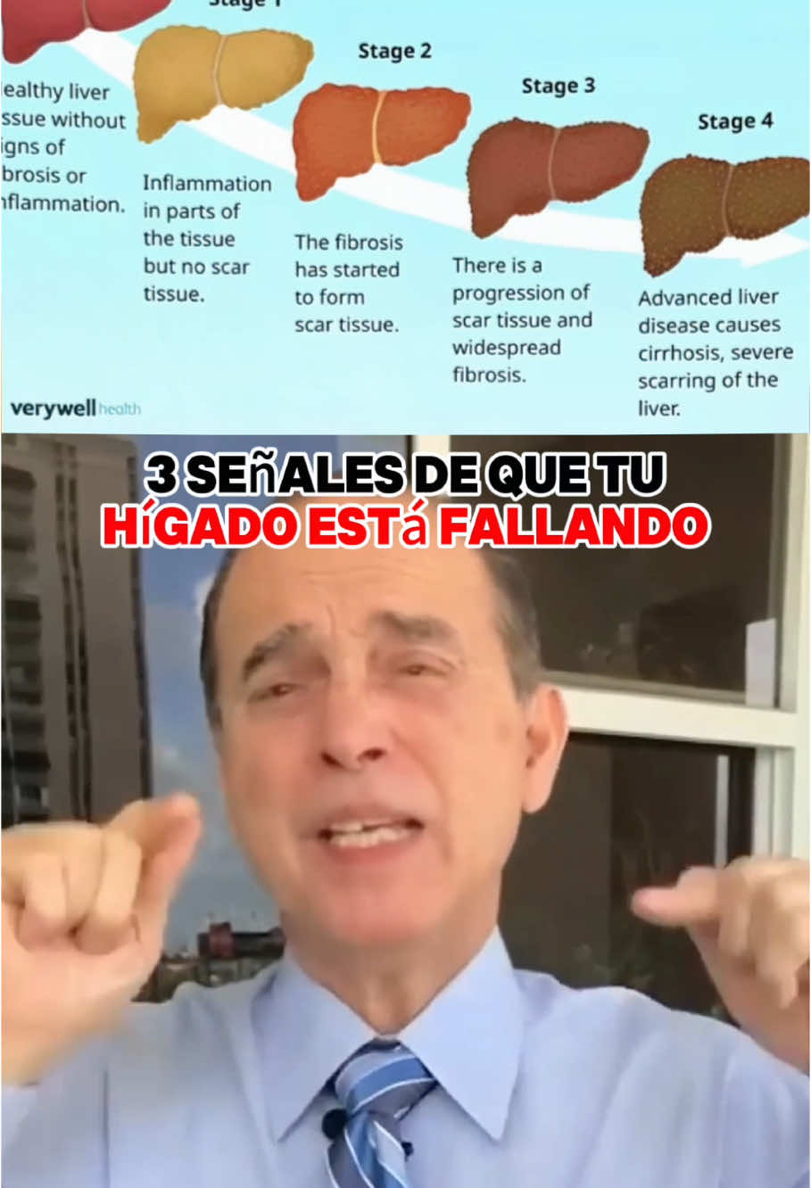 Tu hígado te lo agradecerá. Prueba este remedio natural#DesintoxicaciónHepática #HígadoGraso #AdiósHinchazón #SaludIntestinal #TéNatural #DesintoxicaciónNatural #VidaSaludable #PerderPeso #DigestiónSaludable #Bienestar #HígadoLimpio #TéParaLaVida #SaludYBienestar #RecuperaTuEnergía #CuidaTuCuerpo
