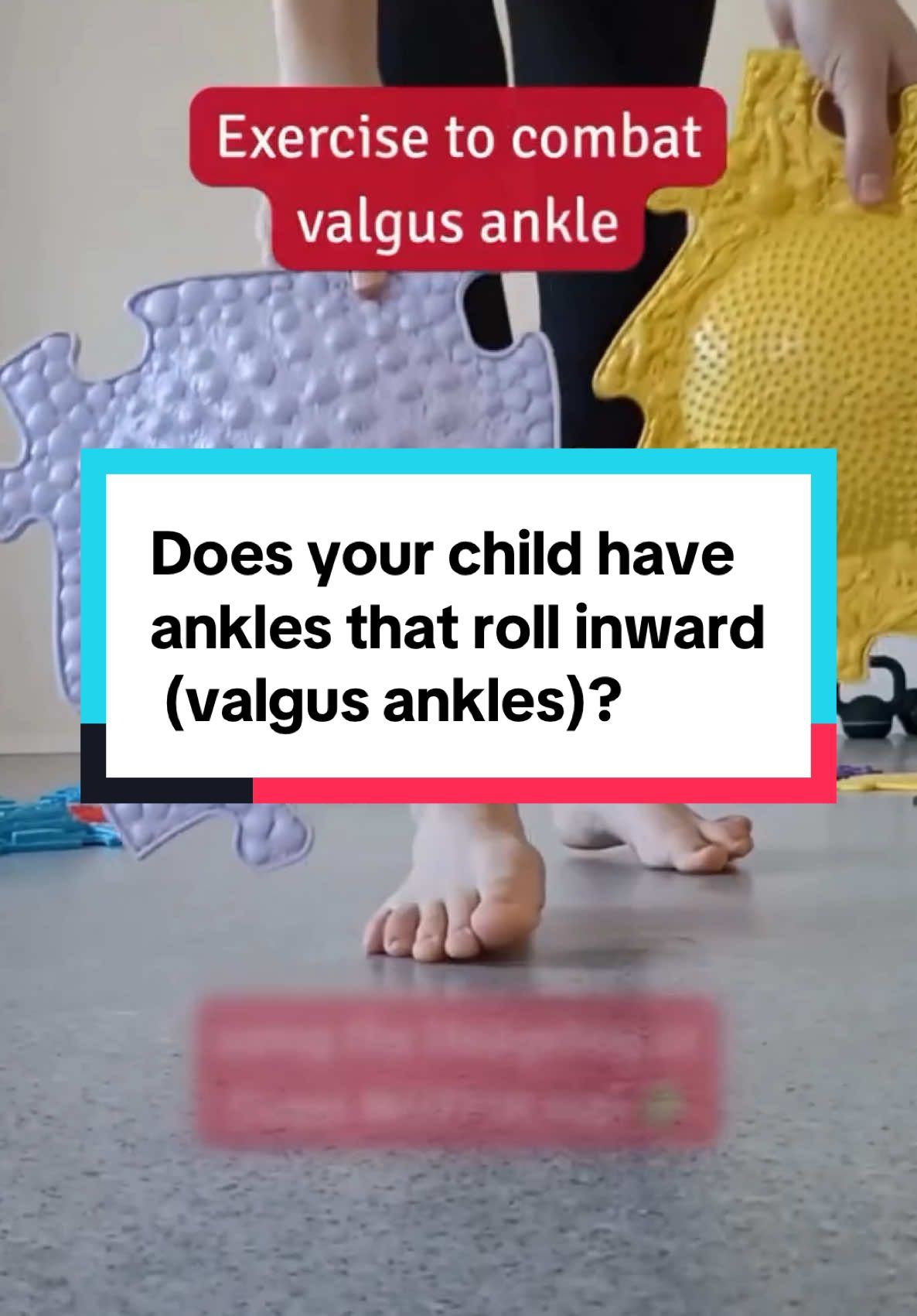 Does your child have ankles that roll inward (valgus ankles)? KEEP WATCHING! #workoutmotivation #healthcare #healthyliving #healthtips #posture #physiotherapy #mumsoftiktok #mumlife #fyp 