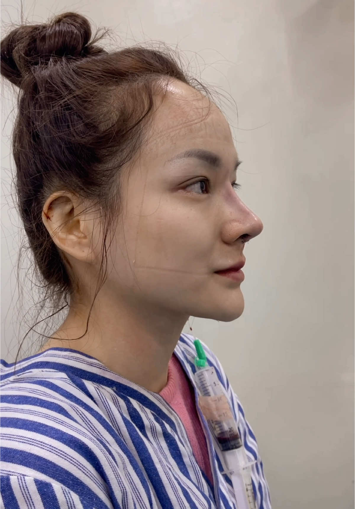 #ລີວິວ #ເສີມດັງ #ສັນຍະກໍາຄົບວົງຈອນ #fyp #flypシ 