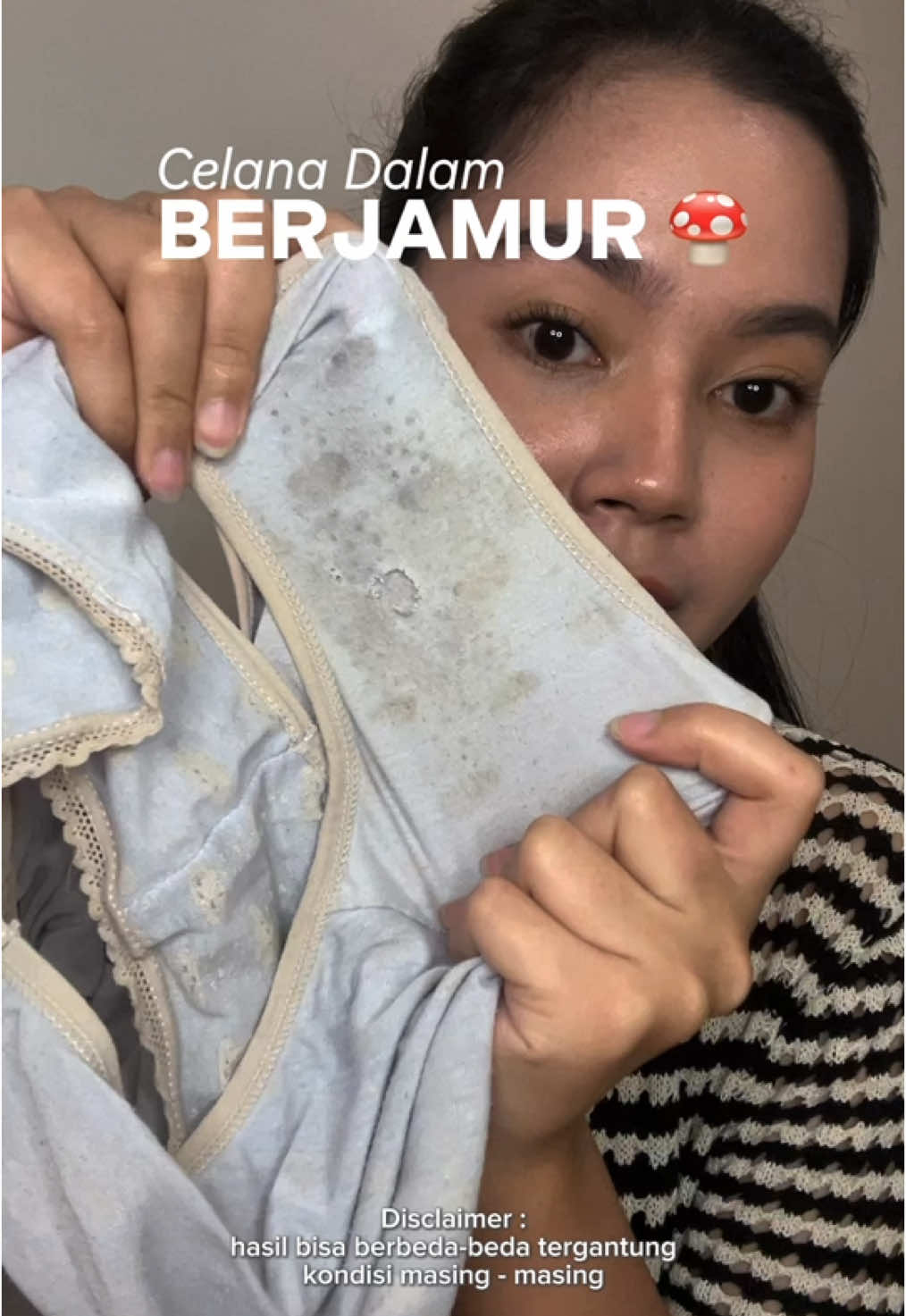 kalo celana udah berjamur jangan dipake lagi better inves ke celana dalem bahan cotton #BekasLuka #Ruam #CreamBekasLuka #CreamGatal #CreamIritasi #CiaraIndonesia 