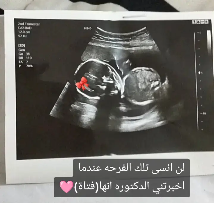 #حبيبتي_وروحي🤍💕🤍 
