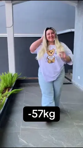 #bariatrica #bariatricsurgery #bypass #bypassgastrico #emagrecer 