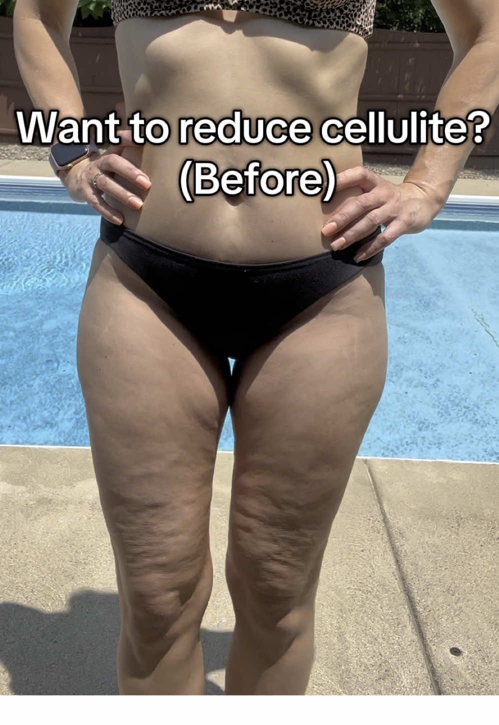 My cellulite and my anxiety over it has ruled me long enough, it’s time for me to take control and face my fears head on! I’ve definitely made some changes that have helped me so much and I’m going to share them all. Follow along my journey of taking control of my mental and physical health #cellulite #womenover50 #cellulitereduction #smoothlegs #50andover #50andoverclub #50andfabulous #fyp #foryoupage #foryourpage #50isthenew30 