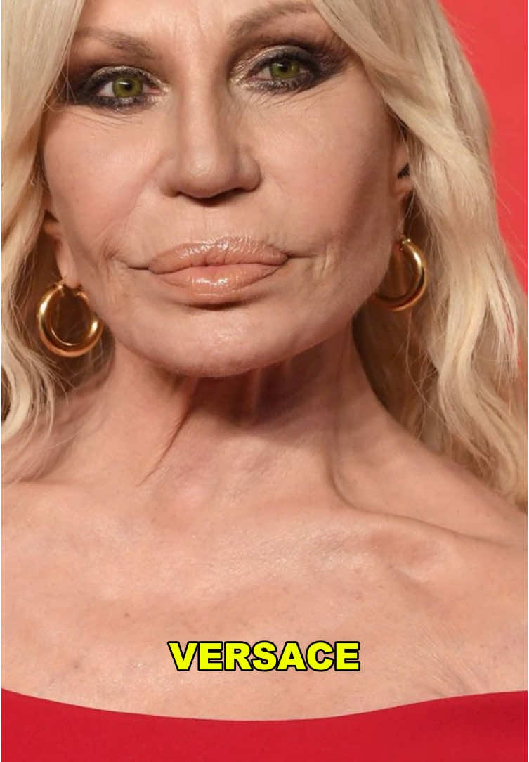 Famosas com o rosto modificado. #curiosidades #famosos #beleza #botox #fama 