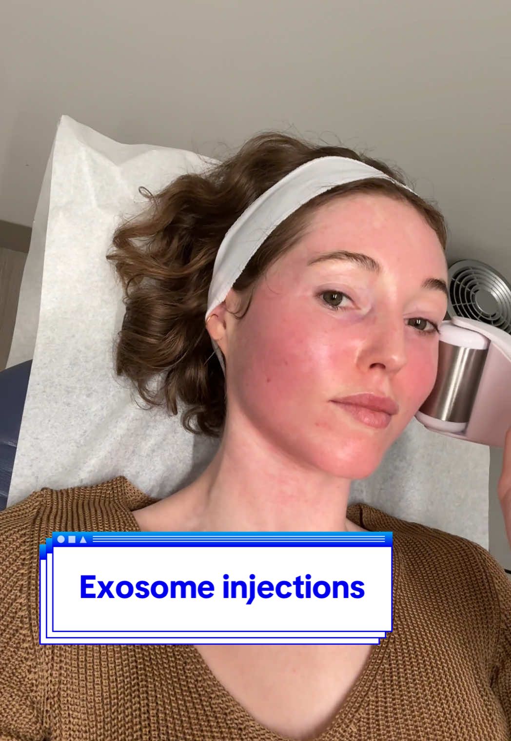 Getting exosomes for the first time! #skintok #exosomes #prf #skintransformation 