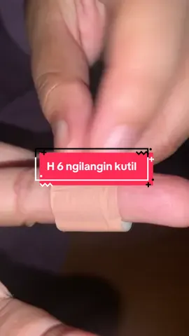 hari ke 6 pake plaster kutil #plestermataikan #plesterkutil #produkbagus 