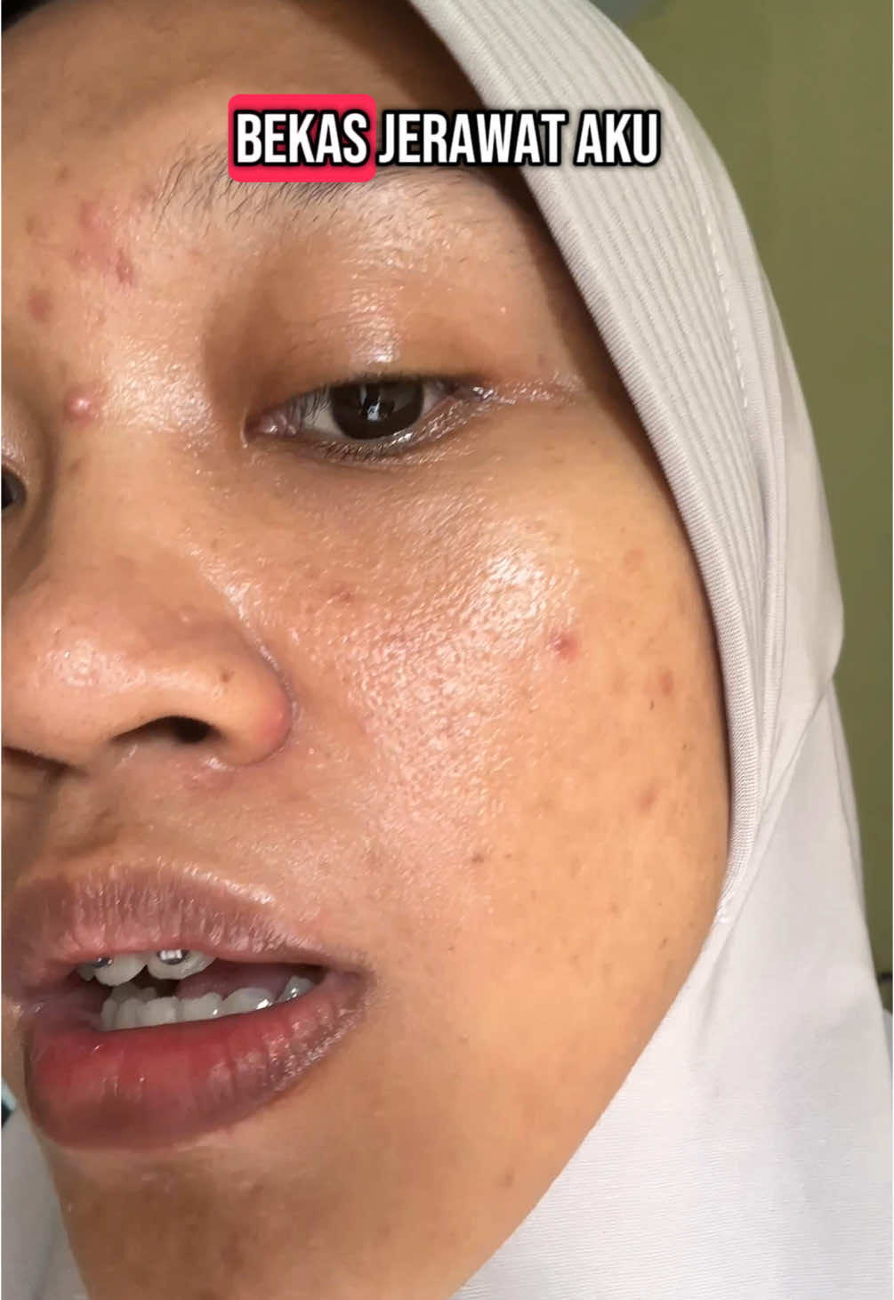 Moisturizer aman sudah BPOM, bantu mencerahkan wajah, dari @MOOYAM.id acne prone skin bisa pakai #mooyam #whiteningcream #basicskincareroutine #amanbumildanbusui 