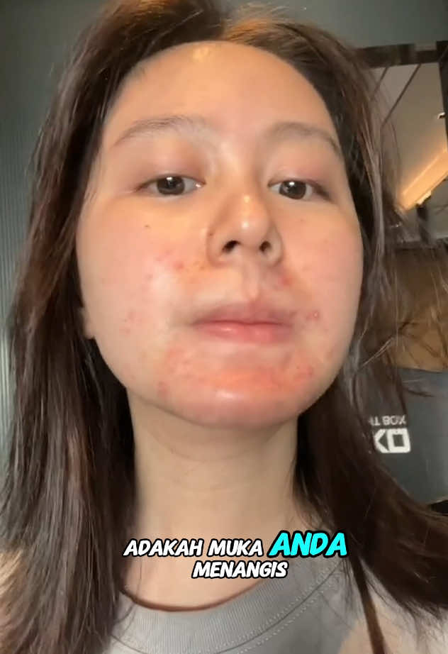 “Cuba selama 3 hari → Jerawat tersembunyi jelas berkurangan, kulit licin dan hebat 😍 Kalau tak tahu apa itu pad pencuci muka silikon, FIKIRKAN LAGI! 🔥 #honestreview #cheapskincare #skincare #phanvietvn 