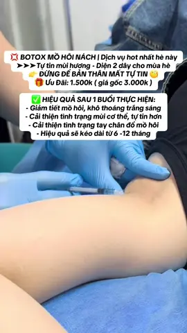 💢 BOTOX MỒ HÔI NÁCH | Dịch vụ hot nhất hè này ➤➤➤Tự tin mùi hương - Diện 2 dây cho mùa hè ✅HIỆU QUẢ SAU 1 BUỔI THỰC HIỆN 🔹  Giảm tiết mồ hôi, khô thoáng trắng sáng 🔹 Cải thiện tình trạng mùi cơ thể, tự tin hơn 🔹 Cải thiện tình trạng tay chân đổ mồ hôi  ✅ Hiệu quả sẽ kéo dài từ 6 -12 tháng ✅ỨNG DỤNG PHÙ HỢP VỚI 📍 Người đổ mồ hôi nhiều ở nách 📍 Người gặp rắc rối với mồ hôi tay chân 📍 Người gặp vấn đề về mùi cơ thể #xu_huong #mồ_hôi_nách #cảithienmohoinach #thâm_nách #mòhoitaychan #mồhoinachnhieu #mòhoicothe #mòhoichan 