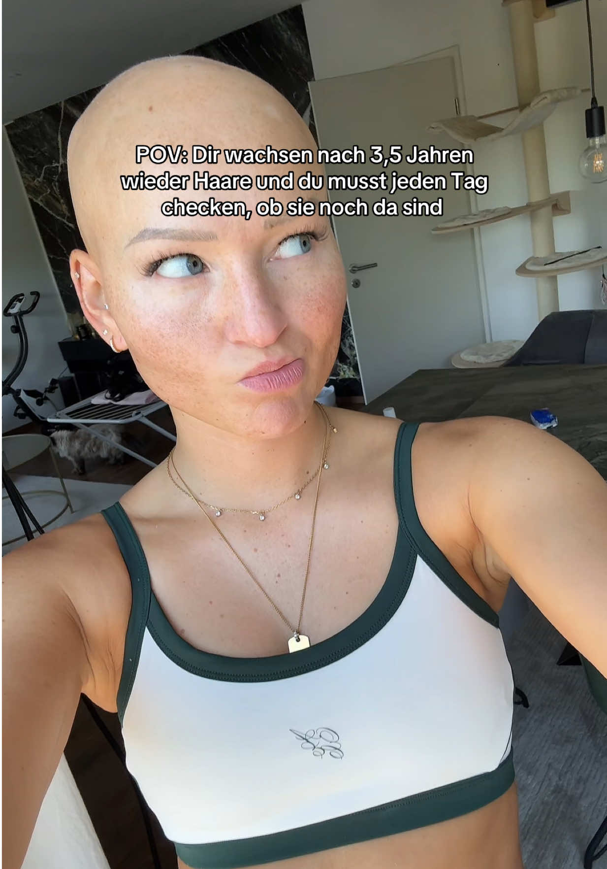 Immernoch unreal 🥹 #alopeciagirl #alopecia #alopeciaareata 