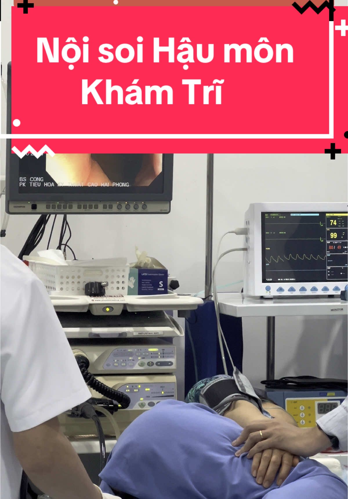 Nội soi Hạu môn, khám trĩ. PHÒNG KHÁM TIÊU HOÁ KỸ THUẬT CAO HẢI PHÒNG. 77a Trực Cát, Vĩnh Niêm, Lê Chân, HP. 0932384226. #noisoi #noisoitieuhoa #ungthu #bscong #noisoidaday #noisoidaitrang #xuhuong #tieuhoa #tieuhoahaiphong #tieuhoakhoe #tieuhoatot #ungthugan #tri #daday #daitrang #thuocnam #thuocnamsuckhoe #nhi #men 