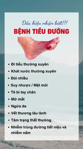 Dấu hiệu nhận biết bệnh tiểu đường #songkhoe247 #xuhuong #viral #tieuduong 