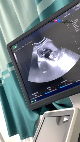 لا استطيع الانتظار لرؤيتك طفلي🧸💗💙#شعب_الصيني_ماله_حل😂😂 #اكسبلور #سوق_الجمعة #girls #اكسبلورexplore❥🕊 #اكسبلورexplore❥🕊🦋💚❤#libya🇱🇾 #تيك_توك 