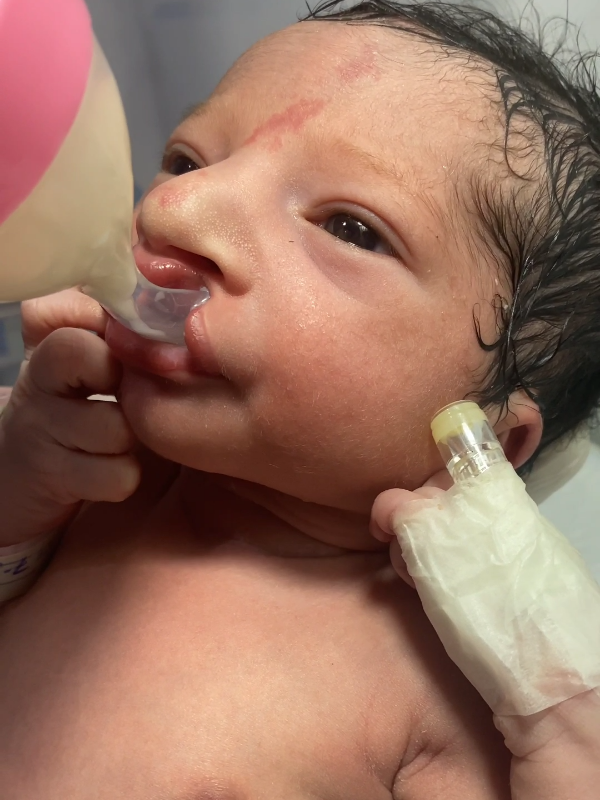Specialized Bottles and Nipple Consider using a bottle with a wider base or one with a cross-cut nipple to facilitate milk flow, especially for babies with a cleft palate.  #creatorsearchinsights 
