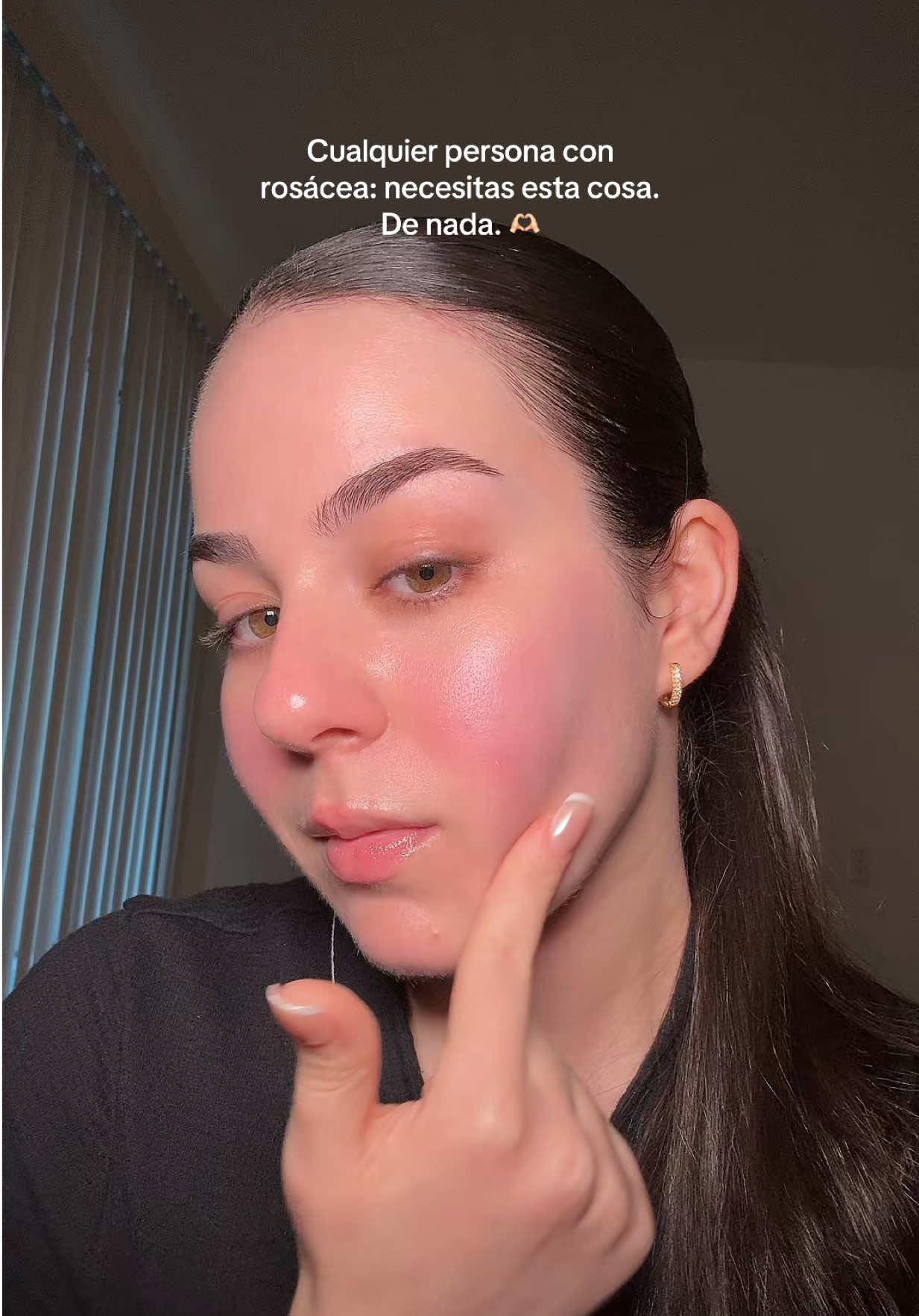 El cicapair se ha convertido en un imprescindible para mi rosácea 🫶🏻🫶🏻 @Dr.Jart+ North America  (esto no es publi, compré el producto con mi dinero) #rosacea #redness #rosaceatips #drjart #cicapair #recomendaciones 
