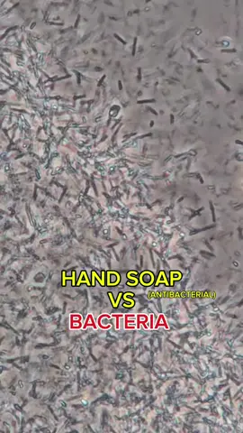 #ConSantanderConecto #fyp #microscope #interesting #bacteria #handsoap 