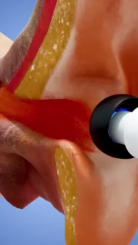 How Loud Earbuds Can Damage Your Ears 😯#LIVEIncentiveProgram #LIVERewards #PaidPartnership 