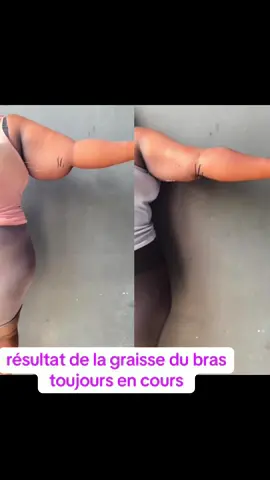 x2 plus fort montre effectivement des résultats  Gros bras perdrelagraisseauniveaudubras graisseendessousdesbras perdrelagraissedesbras senegal graisse Maigrir du bras Graisse au bras #bruleurdegraisse #armfats #graisse #minceur #grosbras 