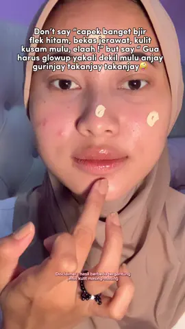 Cuma daycream doang bisa mengubah menjadi glowing🥰‼️🤏🏻#kjoel #mencerahkan #skincarepouch #cerah #glowing #skincareroutine #menghilangkanflek #skincaremurah #GlowUp #pakerutin #hempaskusam #cerahbanget #murah 