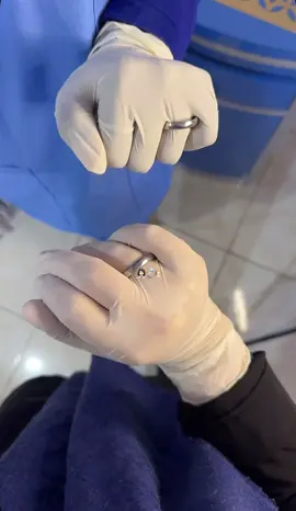 💍👩🏻‍⚕️ #مالي_خلق_احط_هاشتاقات #ممرضه👩‍⚕️💉 #مصراتة #ليبيا🇱🇾 #تمريض #tibbbacisi🚑👩‍⚕️💉💊 #💊 #تصميم_فيديوهات🎶🎤🎬 #مالي_خلق_احط_هاشتاقات #ترند_تيك_توك #تصويري📸 #هشتاق #ممرضه👩‍⚕️💉 #تصميمي #مشاهير_تيك_توك_مشاهير_العرب #لايكاتكم #اكسبلورexplore #اكسبلور #تصويرنا #hocycogivui👩🏻‍⚕️💙 #ممرضة❤️👩🏻‍⚕️ #estudiantedeenfermeria👩🏻‍⚕️🏥💉❤ #زواج #ترند #ترند_تيك_توك #مشاهدات_تيك_توك #مشاهدات100k🔥 