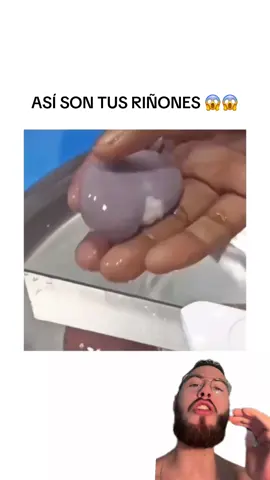 Dime qué piensas de esto. ##pablopilatesreal##riñones##riñones##infecciondeorina##calculorenal##insuficienciarenal##anatomia##curiosidades##consejosdesalud##consejossaludables