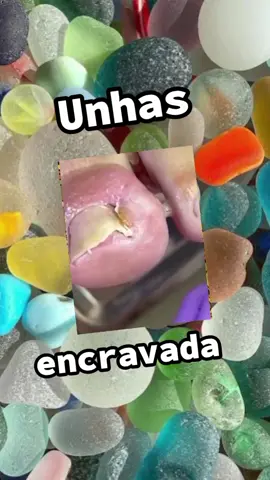 hummm #nails #unhasencravadas #unhaencravada #satisfyingvideos #toenails #ingrowntoenail 