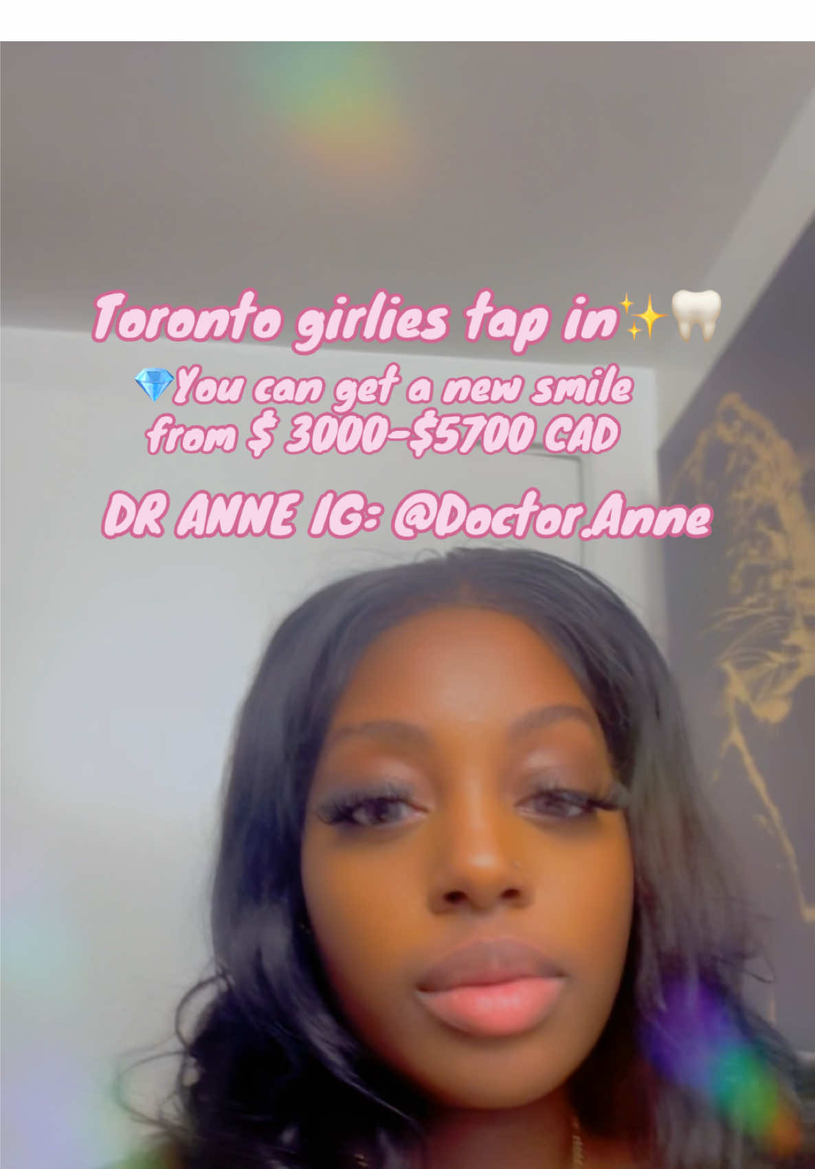 #veeners #veneer #porcelainveneers #porcelain #toronto #BlackTikTok #blackgirlluxury #blackgirlluxurytiktok #torontotiktok #torontoveneers #torontodentist #cosmeticdentist #cosmeticdentistry 