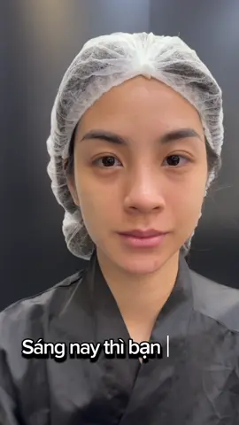 Sáng xấu chiều đẹp bất ngờ chưa💉👄#THANHHANGBeautycenter #MOIXINHMOINGAY #LAMDEPCHUANYKHOA #LAMDEPCHUANYKHOA #TIEMMOIDEP #FILLERBOTOX 