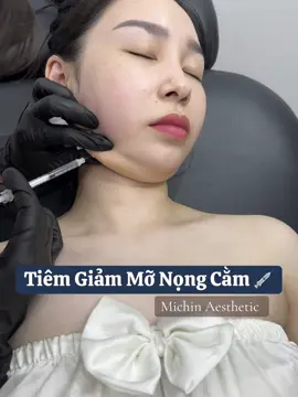 Giảm mỡ nọng cằm sale còn 1xxx nè mn #michinfillerbotox  #daotaohocvienchuyennghiep  #tiembapkarisma  #daotaofillerbotox 