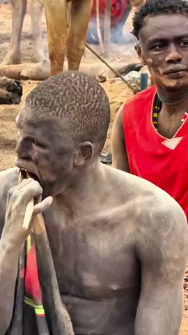 Un peuple sans dentiste, sans stress #videoviral #france #belgium 