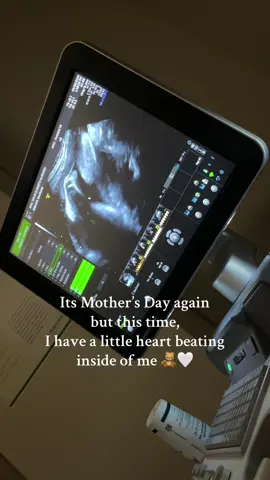 His little foot 🥹 tiktok deleted the other one I posted :/ #firsttimemom #boymom #mothersday #pregnant #ultrasound 