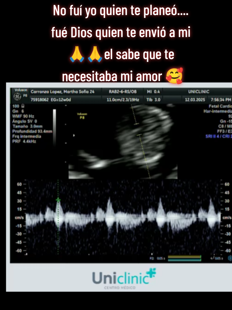 Gracias mi Dios 🥺 🙏escuchaste muchas veces mis oraciones y me concediste mi mas grande amor 🥰🥰🤰 #embarazadafeliz #mamaprimeriza💜💓 #feliz #miamorbonitoo💙👶🥰🥰 