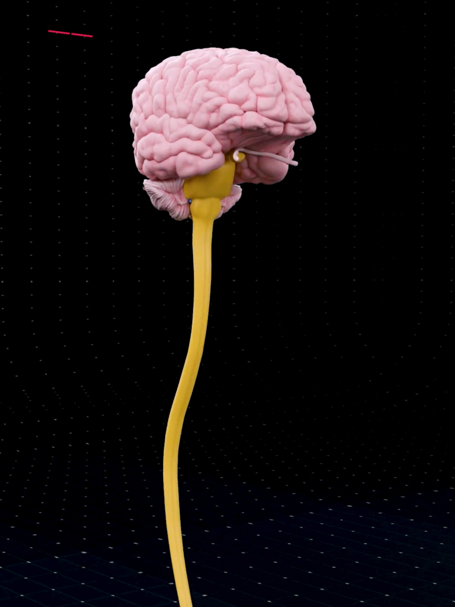 Brain and spinal cord 🧠 . . Brain and Spinal Cord: The Central Nervous System Brain: The body's control center, responsible for thought, memory, emotion, movement, and other functions. It consists of the cerebrum (higher functions), cerebellum (coordination and balance), and brainstem (vital functions). The cerebrum is divided into lobes: frontal (planning), parietal (senses), temporal (hearing and memory), occipital (vision). Spinal Cord: Extends from the brain, transmitting sensory information from the body to the brain and motor commands from the brain to the muscles. Controls reflexes. Meninges: Protect the brain and spinal cord (dura mater, arachnoid mater, pia mater). Cerebrospinal Fluid (CSF): Surrounds the brain and spinal cord, providing protection, nutrition, and waste removal. Interconnectedness: The brain and spinal cord work together. The brain sends signals through the spinal cord, and the spinal cord transmits sensory information to the brain.. . . #smartdoctor1 #cardiology #anatomia #anatomía #education #anatomi #ANATOMY #cardio #anatomy #heartanatomy #medicina #3danimation #doctor #pregnancy #pulmonaryhypertension #pregnant #baby #gravidez #medstudent #animation  #brainanatomy  #brain  #maleanatomy  #reproductivesystem #anatomy #anatomía #解剖学 #해부 #anatomia #anatomie #دماغ #pregnancy #heart #pregnant #medicina #doctor #माहवारी #月経 #frontal  #cervello  #gravidez #Cérebro  #umana  #Childbirth #creier  #ベイビー #베이비  #Smart_Doctor  #femalemodel #تشريح