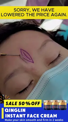 If you have wrinkle problems, the best moisturizing anti-wrinkle creams are here! #qinglin#eyeream#neckcream#skincare#removewrinkles#wrinkle #TikTokShopSpringGlowUp#springtok ZLH 