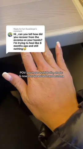 Replying to @Cyn Guadalupe I cut out hand sanitizer, perfumes, hand soap just a tiny bit on fingertips/palms only no rubbing onto skin, no washing dishes without gloves, no washing hair with perfumed shampoo & conditioner. Then no creams but left over Dr organic aloe Vera gel that I apply to my face then the excess on my hands. Less is definitely better! Less products = healing hands #handeczema #dyshidroticeczema #eczematips 