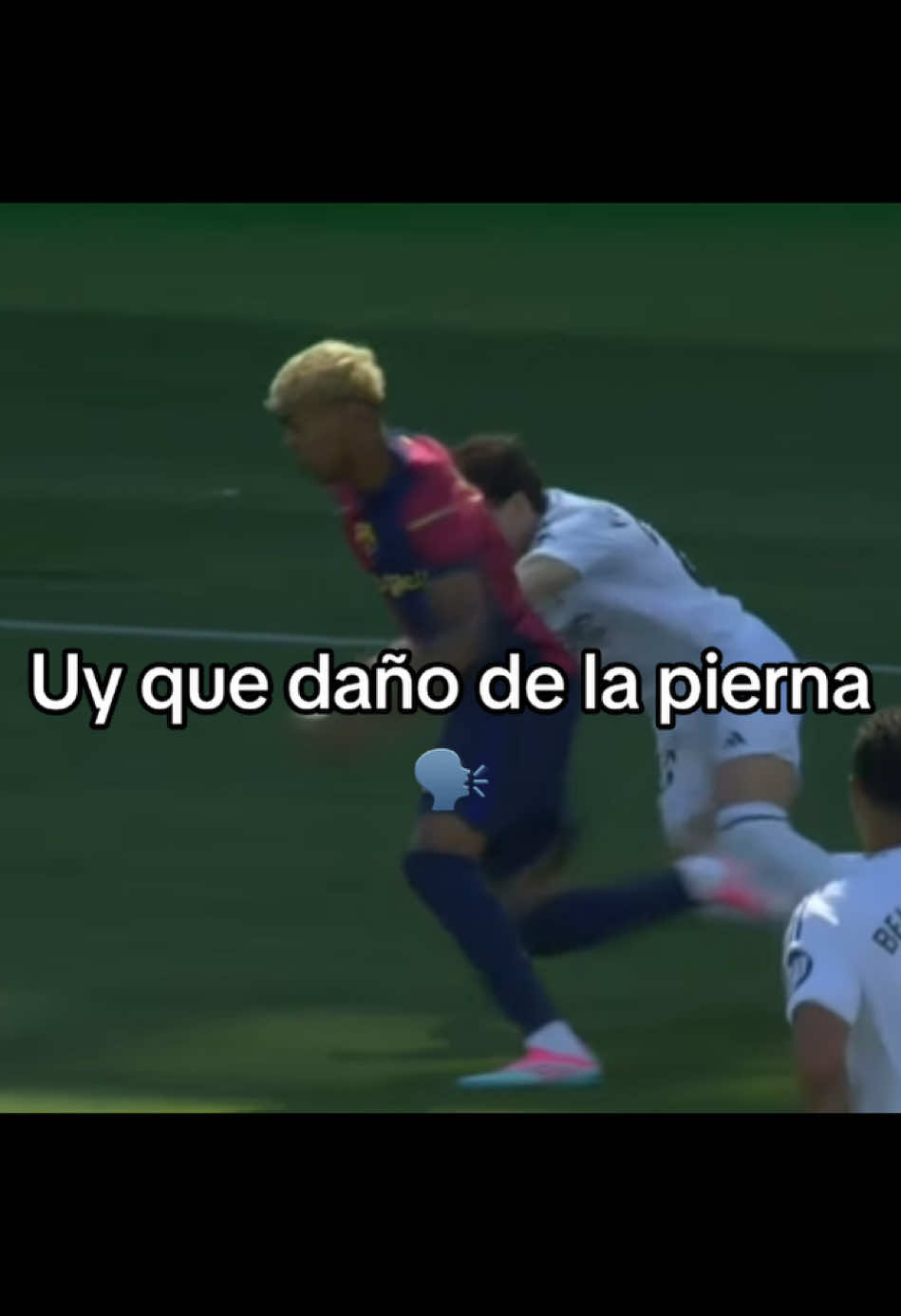 Uy que daño de la pierna #barcelona #Meme 