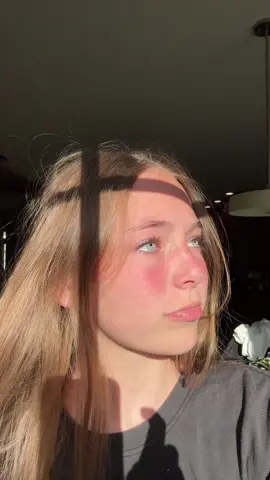 i’m so burnt