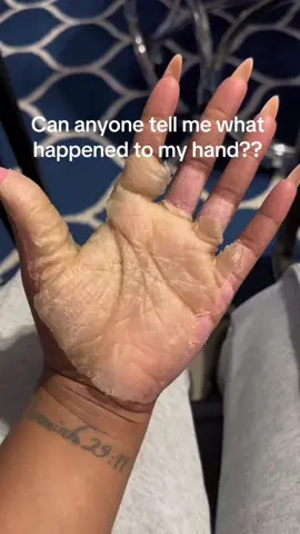 Are you tired of dealing with rough, dry, and cracked skin on your hands? Do you long for hands that are soft, smooth, and supple? Look no further。TikTok Viral Exfoliating Oil extra strong peel oil#wow #hot #Tiktok 