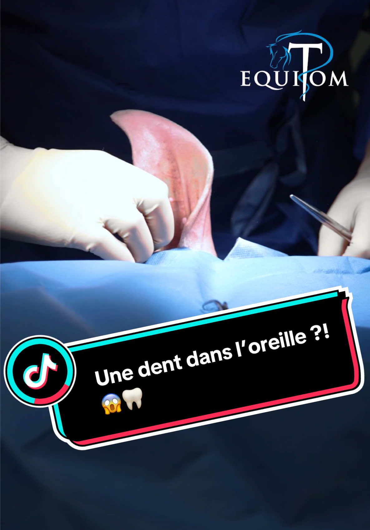 🦷 Une dent dans l’oreille ! 😱 Ce cheval présentait une fistule persistante à la base de l’oreille, accompagnée de sécrétions quotidiennes. Les examens d’imagerie (radiographie et échographie) ont révélé la présence d’un kyste dentigère, une anomalie congénitale rare où une dent se développe anormalement dans le crâne. 🔹 Chirurgie de haute précision : la fistule, le sac kystique et la dent profondément ancrée ont été retirés avec beaucoup de délicatesse. La zone étant riche en nerfs et en muscles sensibles, chaque geste doit être soigneusement maîtrisé pour éviter tout risque de lésion grave. Grâce à cette intervention, ce cheval pourra enfin être soulagé de cette gêne permanente.  💙 Ce cas nous a été confié par Pairi Daiza, et reflète parfaitement la belle collaboration entre passionnés du bien-être animal. 🤝✨