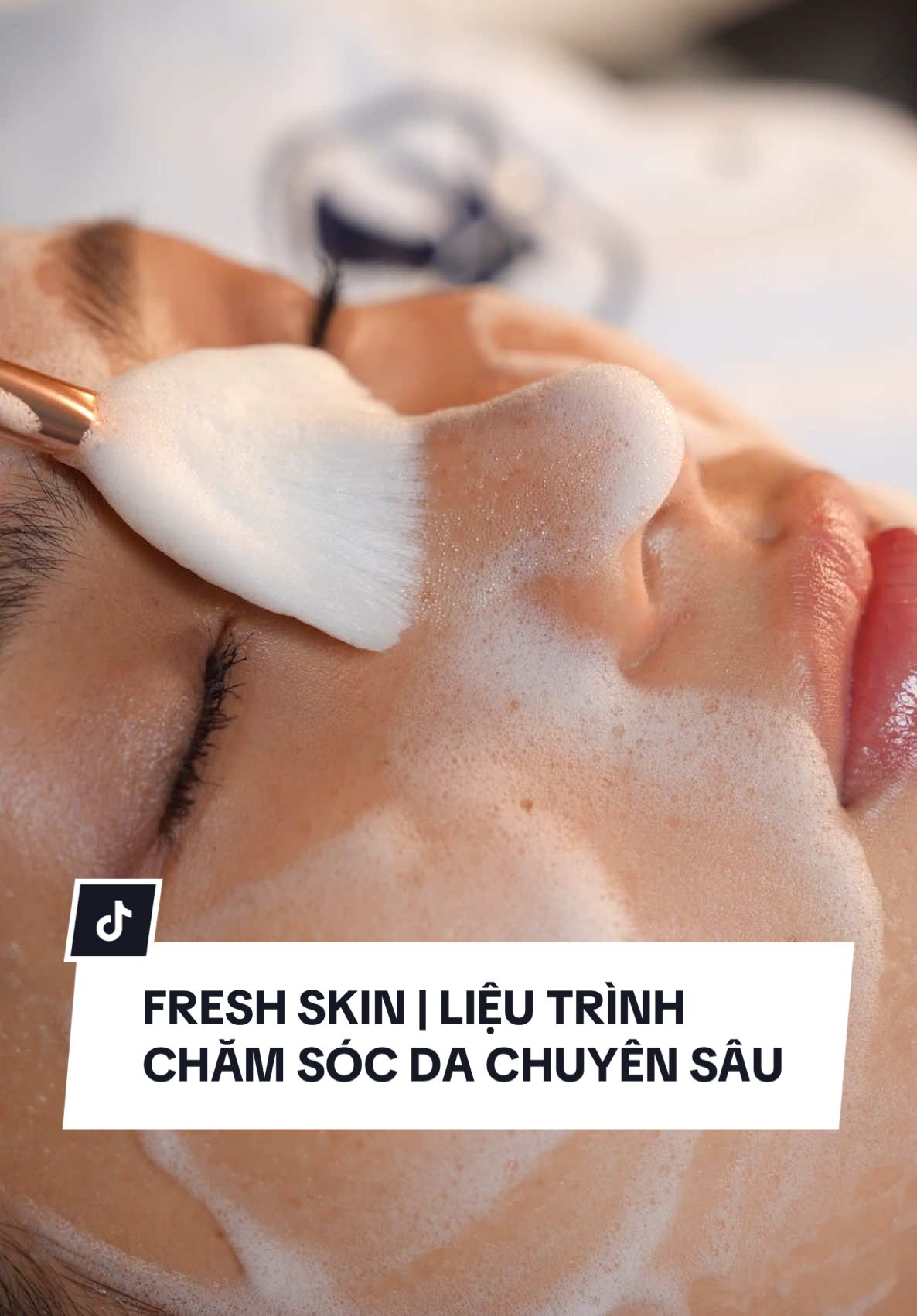 Liệu bạn đã biết đến liệu trình Fresh Skin #gaspa #xuhuongtiktok #skincare #clinic #trending #feedback #freshskin 