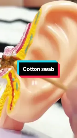 Klo beraihin kuping itu pake cotton swab yang kaya gini ya #korekkuping #cottonswab #cottonbuds 