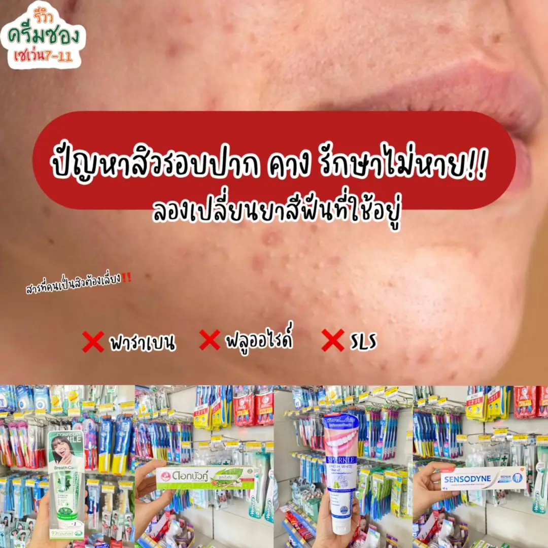 สิวรอบปาก สิวคางใช้อะไรก็ไม่หาย ลองเปลี่ยนยาสีฟันดู#ครีมซองเซเว่น #รีวิวบิวตี้ #ของดีบอกต่อ #รีวิวเซเว่น #บิวตี้ #ดูเเลตัวเอง #ของดีบอกต่อ #ยาสีฟัน #สิว #สิวอุดตัน 