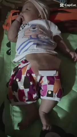 Còn 1tháng nữa ik phẫu thuật mở hậu môn cho con r mẹ phải ik đau  kiếm đủ tiền cho con ik phẫu thuật đy🥺 m.n ik qua xin một lượt chia sẻ với a #Xuhuong 