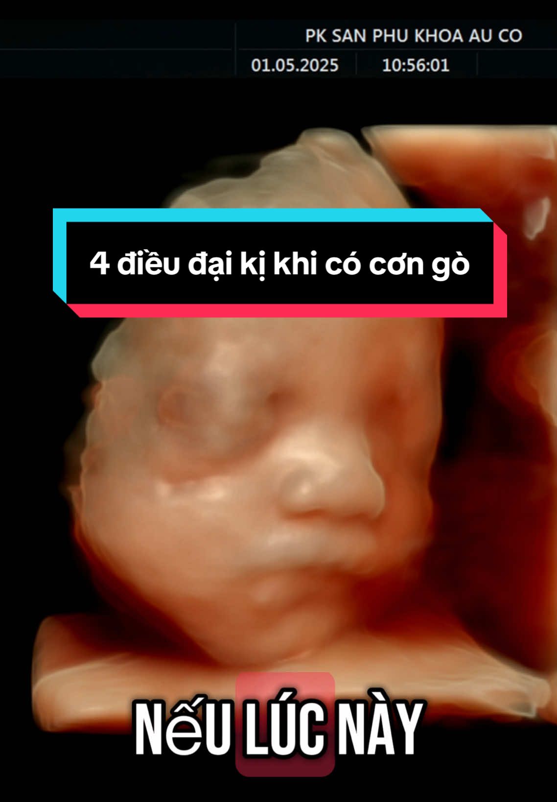 4 điều đại kị khi co cơn gò mẹ bầu cần phải biết